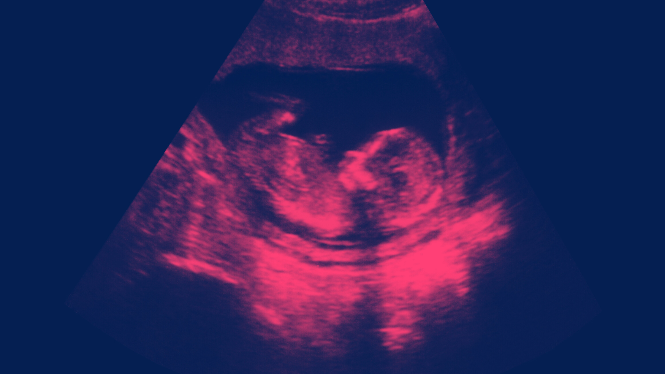 Saúde da placenta por que ela é essencial para o sucesso da gestação